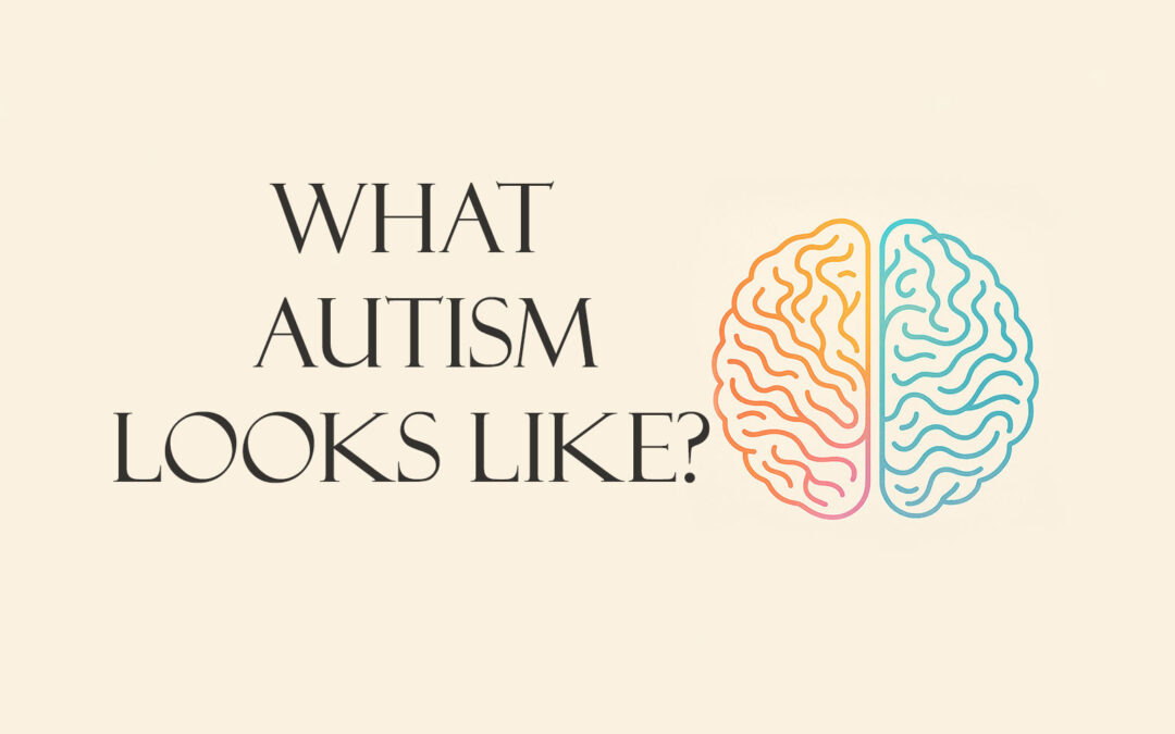 What Autism Looks Like?